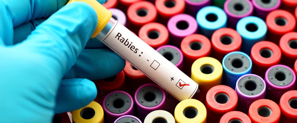 Blood vials for rabies testing titer.